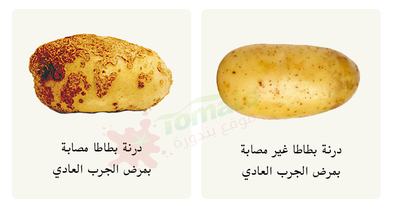 مرض جرب البطاطس البكتيري